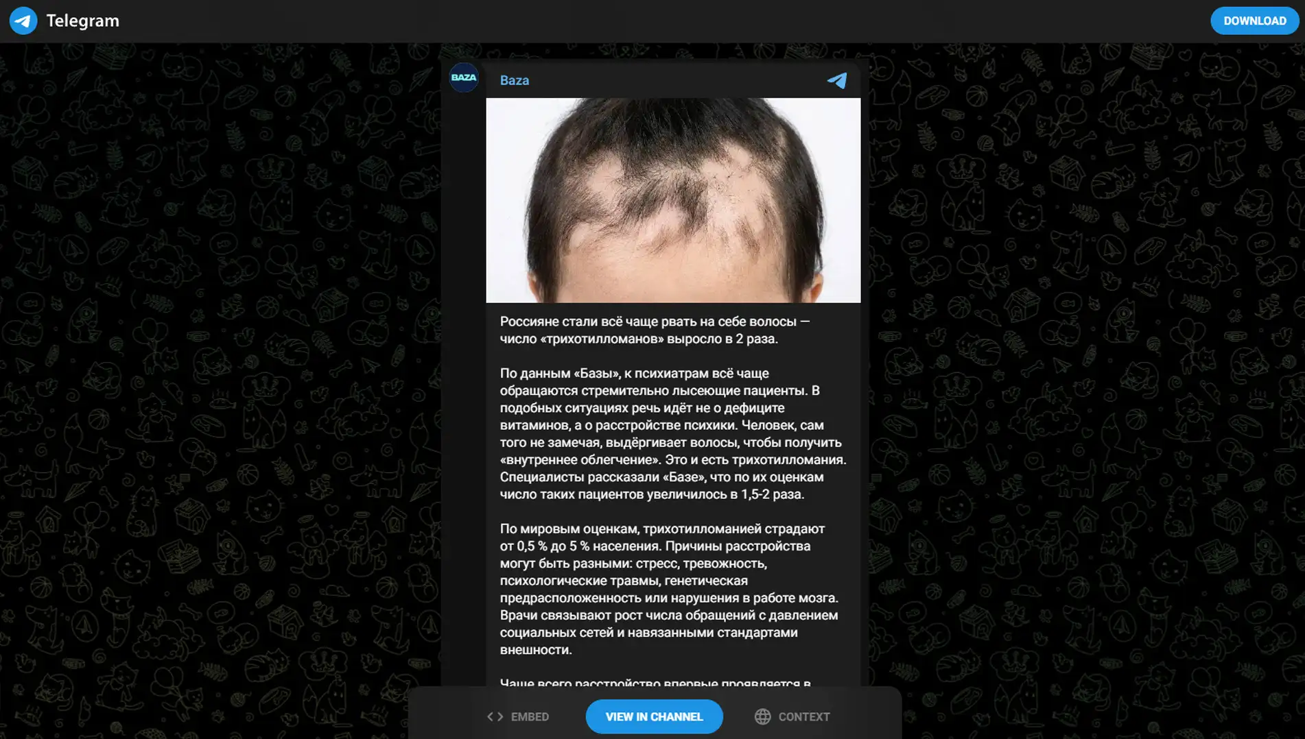 Обложка статьи Психиатр-нарколог, основатель «Клиники доктора Калюжной» Марина Александровна Калюжная рассказала в Telegram-посте о росте трихотилломании. Ознакомьтесь с материалом: